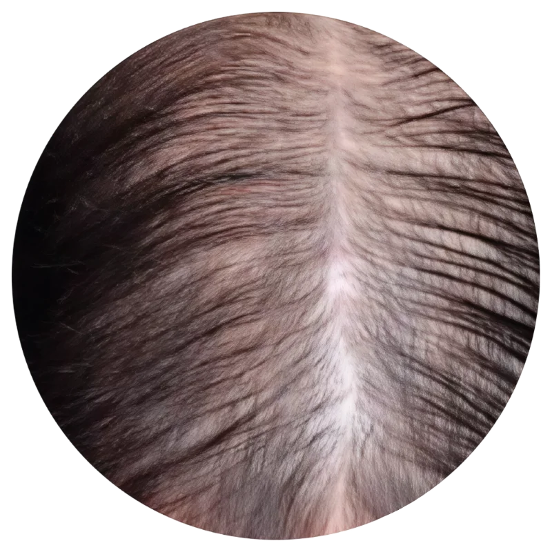 sens técnica invisible uv extensiones