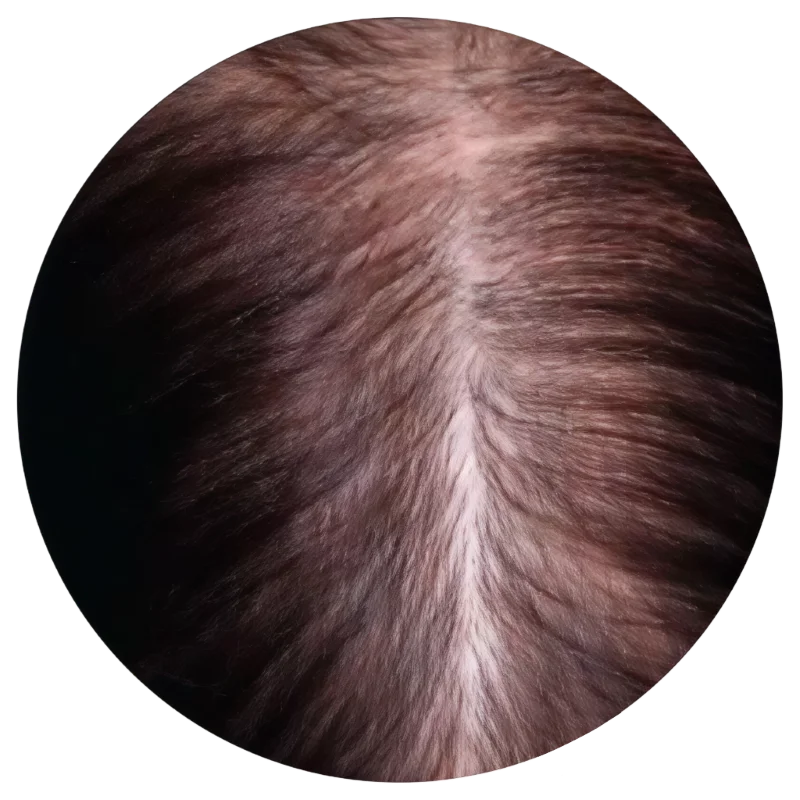 sens técnica invisible uv extensiones